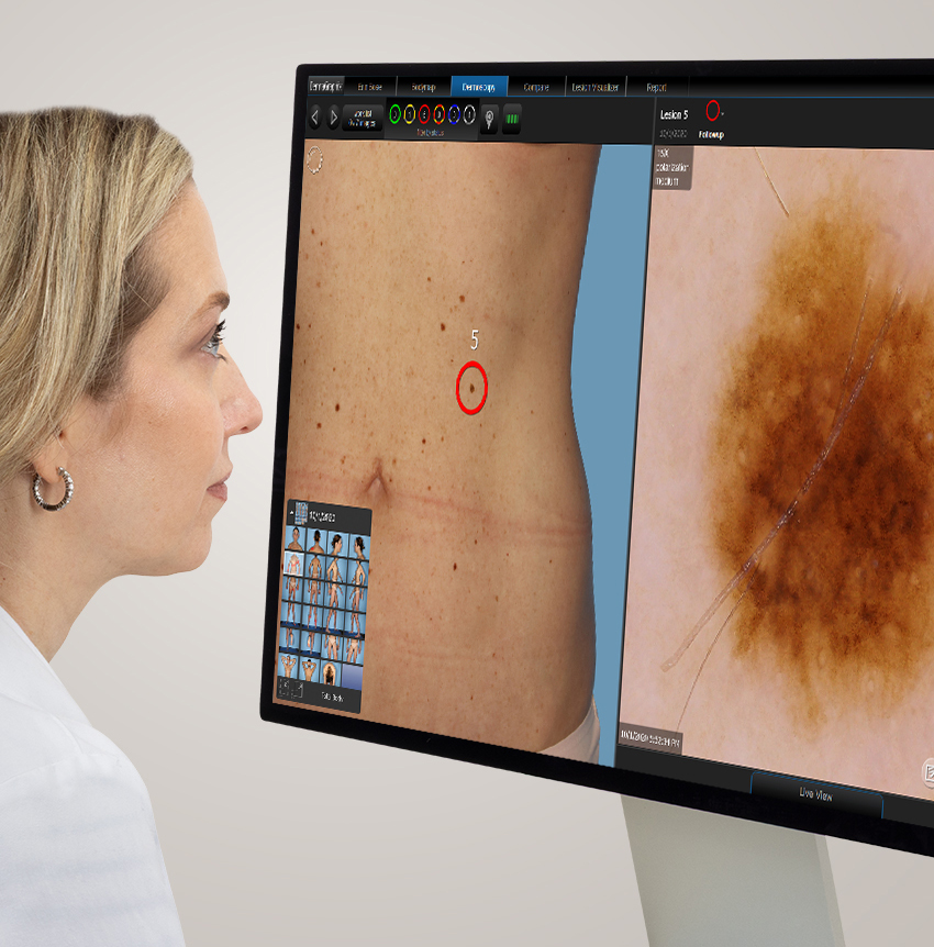 Canfield Scientific IntelliStudio3 full body mole mapping system at Montrose London Belgravia
