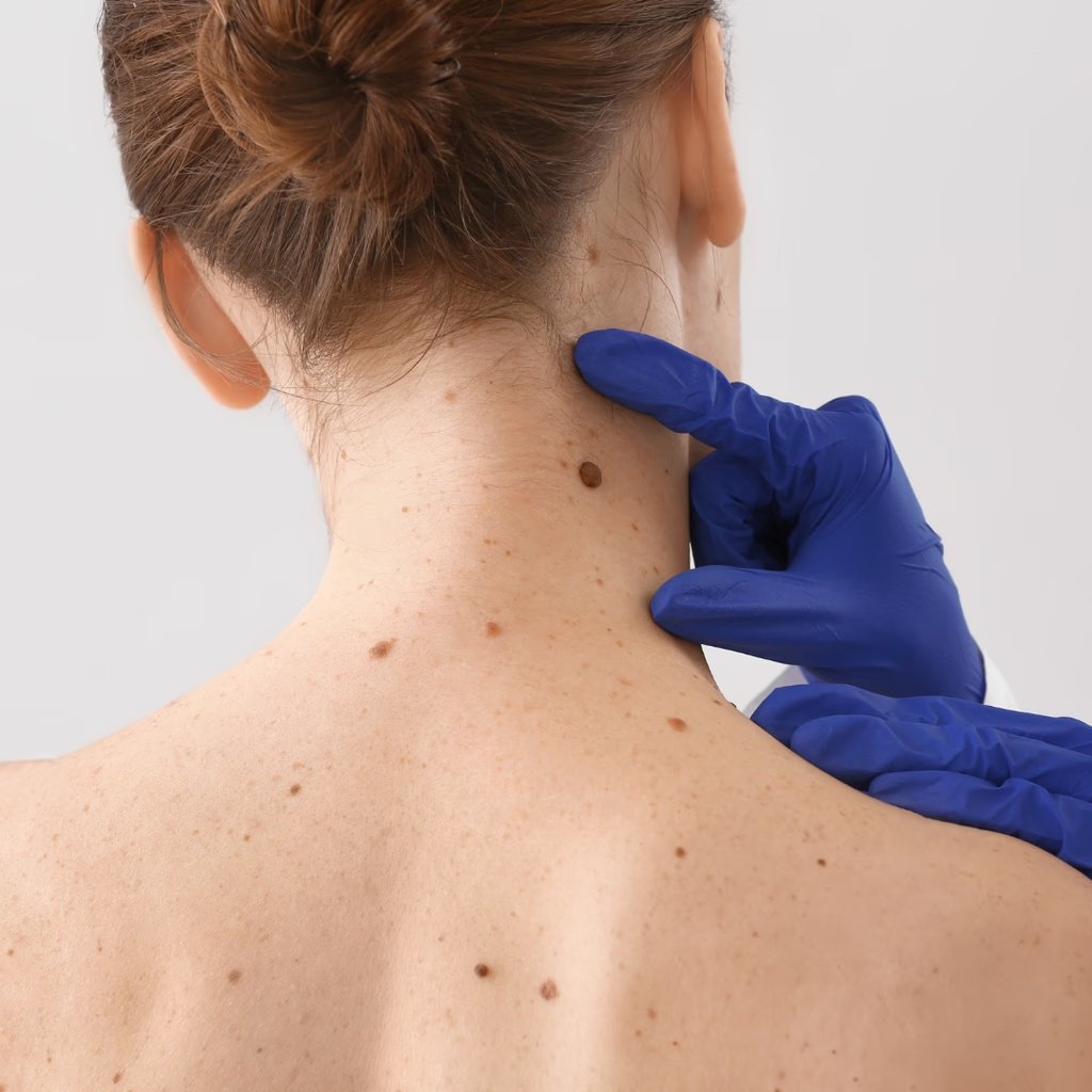 Consultant-led dermatology treatment at Montrose